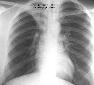 Pasted Graphic 1