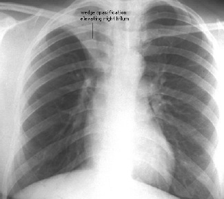 Pasted Graphic 3